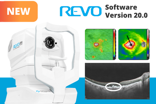 Read more about the article REVO Software 20.0